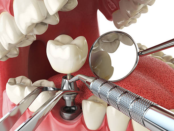 Best 24-Hour Emergency Dentist in Shenandoah Farms, VA
